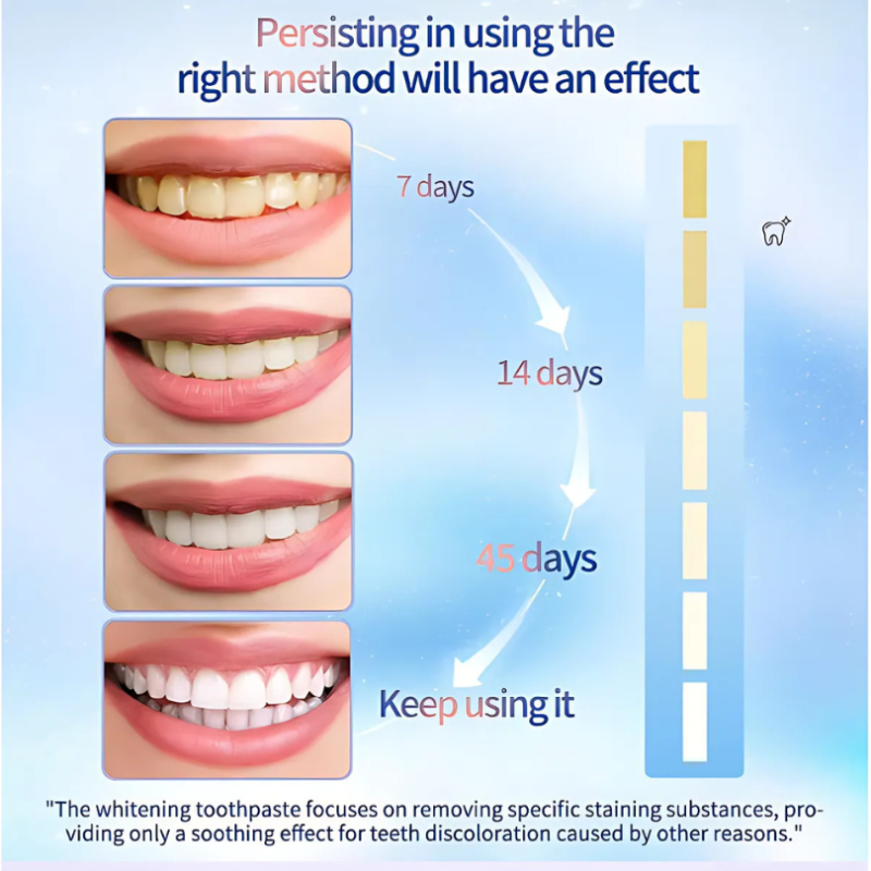 WhiteningToothpaste 1+1 FREE: Niacinamide Whitening And Stain Removal Toothpaste