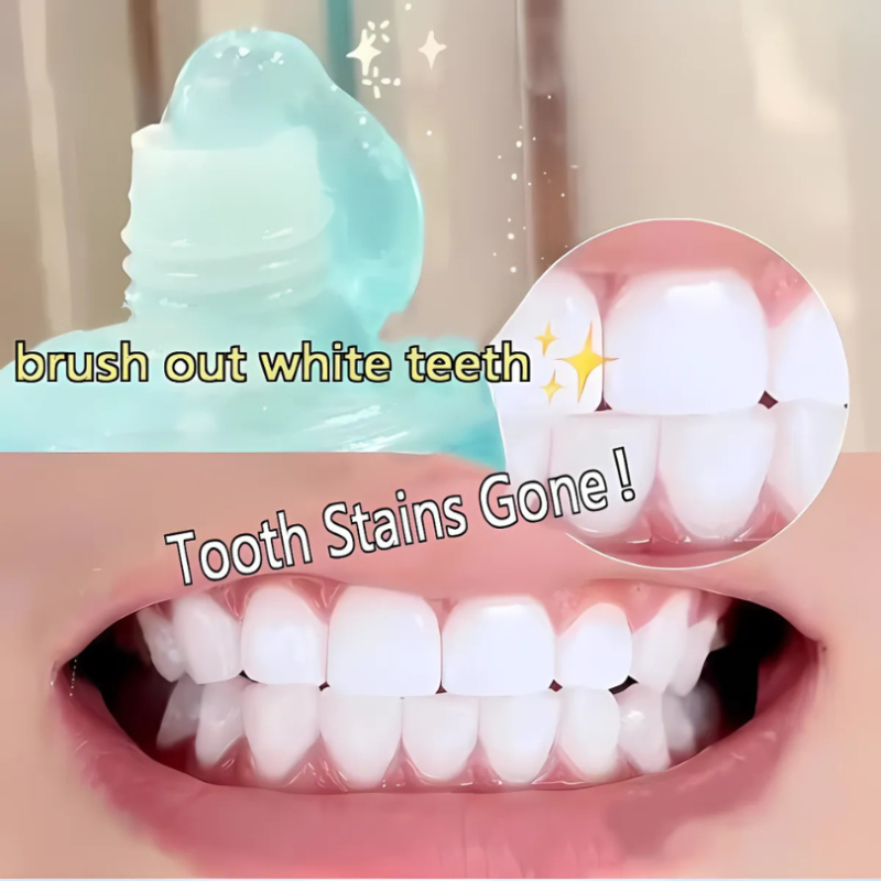WhiteningToothpaste 1+1 FREE: Niacinamide Whitening And Stain Removal Toothpaste