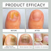 NailDrops 1+1 FREE: Liquid Nail Fungus Repair Healing Drops