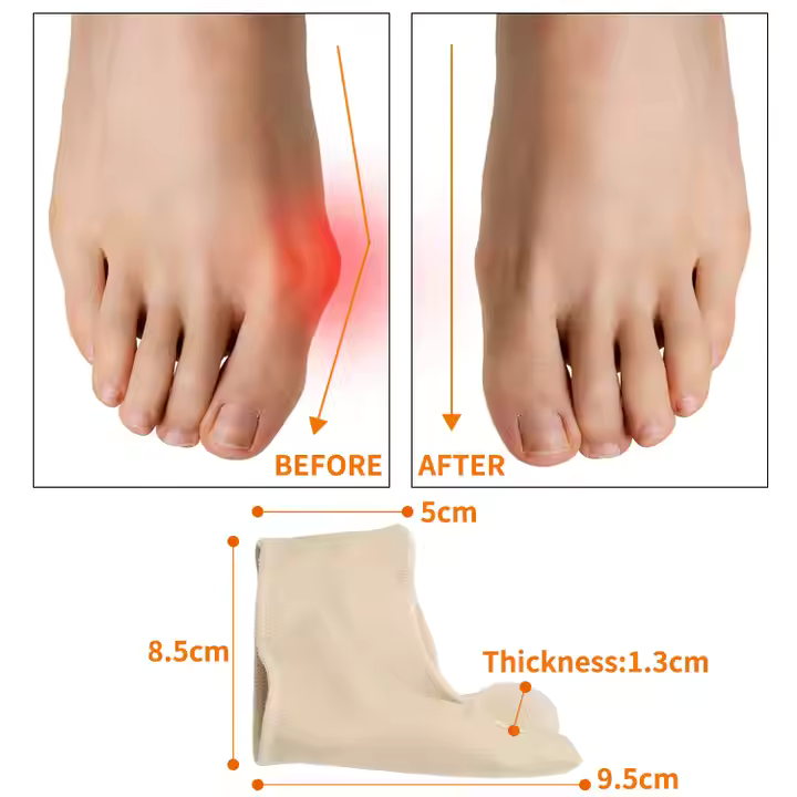 ToeCorrector: Bunion Corrector Big Toe Separator Foot Pad