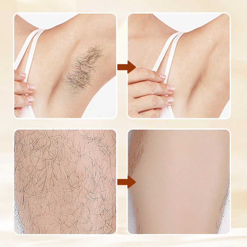 HairErase – Gentle Hair Removal Cream